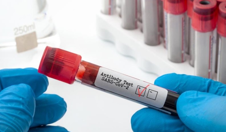 Нови 2 289 случая коронавирус в България Те са установени